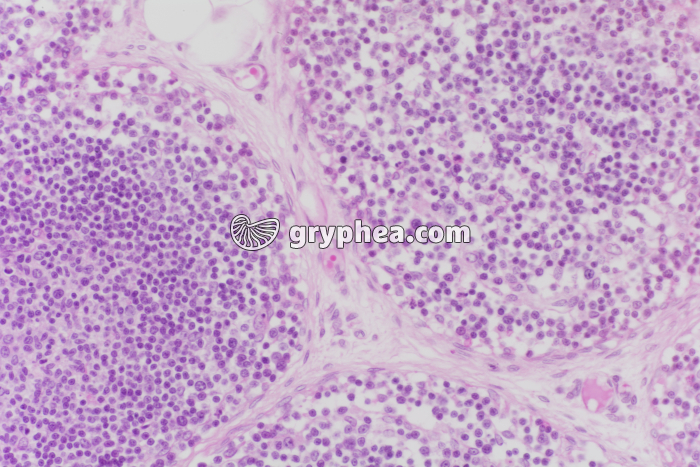 Thymus x100 - gryphea.org